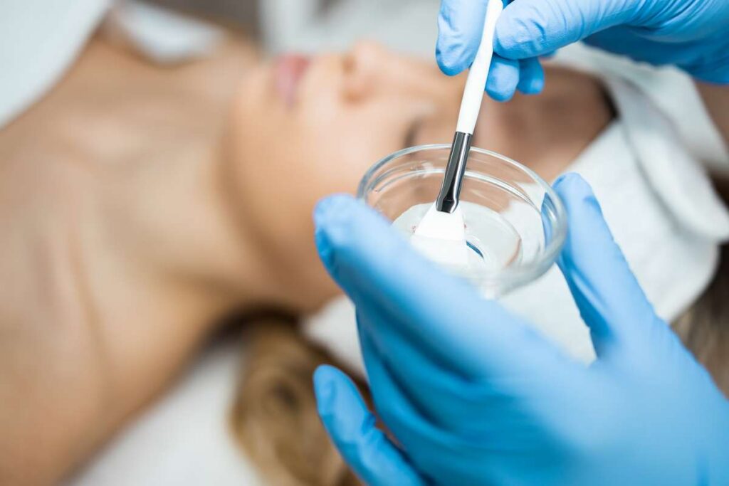 Chemical Peels treatment in San Diego