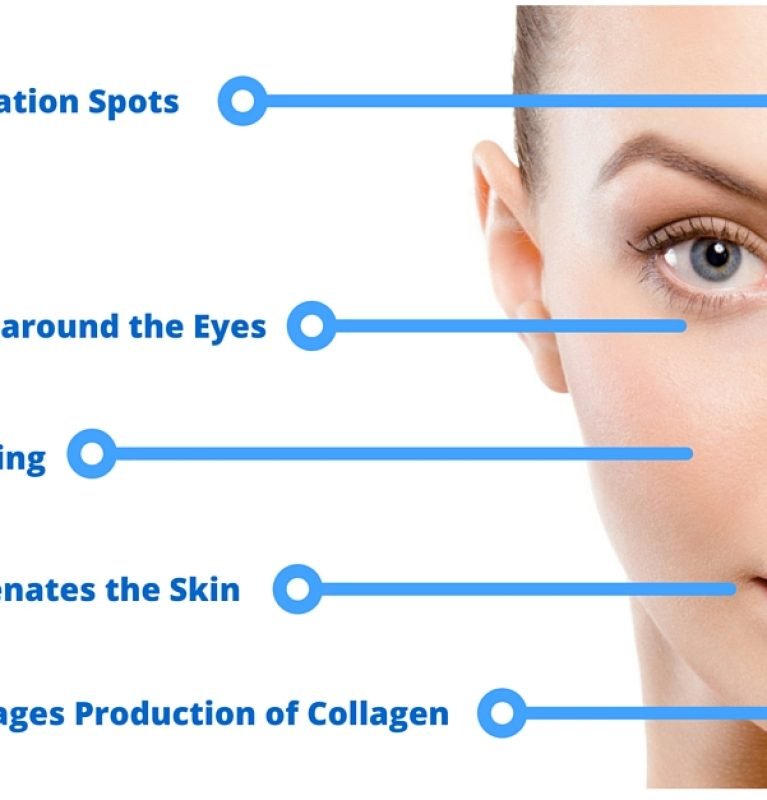 Micro-needling-CIT-Diagram